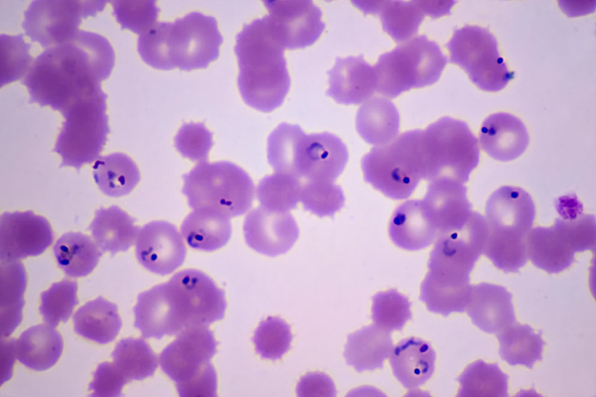 A Mutation Is Making It Easier for Drug-Resistant Malaria to Spread