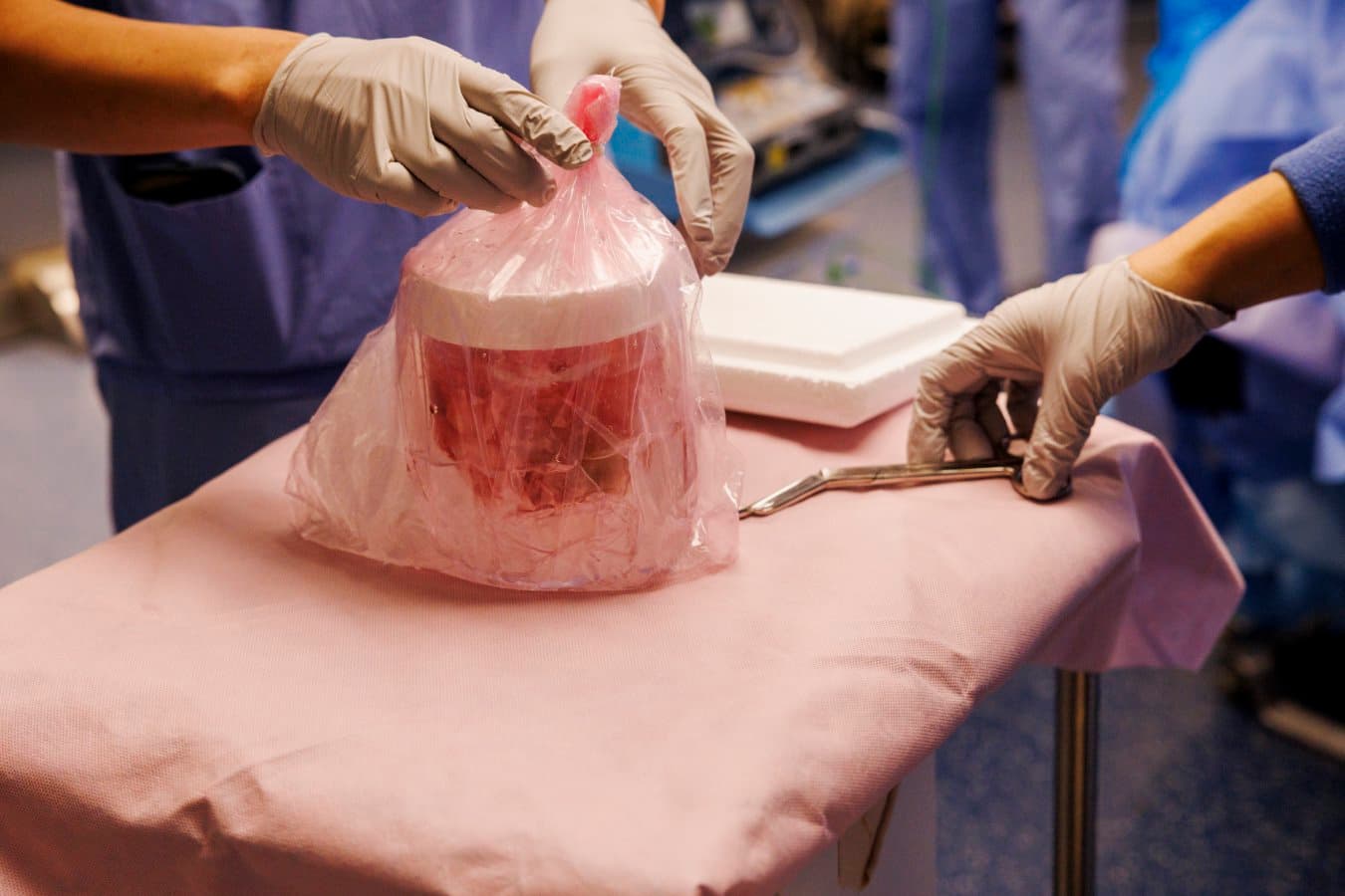 Pig kidney kept a man off dialysis for nine months in world first