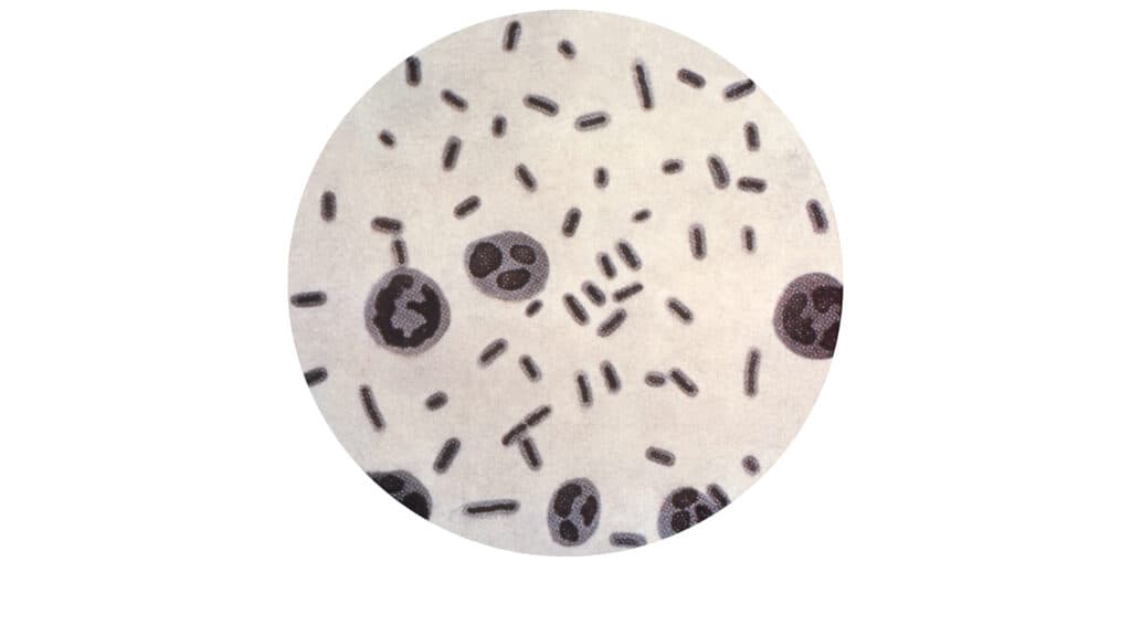 STAT+: Merck discontinues a crucial antibiotic despite concerns over superbug resistance