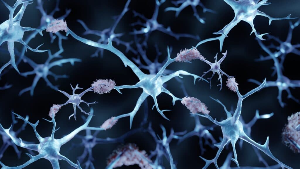STAT+: Preliminary trial results suggest a path to a safer Alzheimer’s treatment