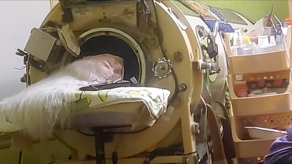 Martha Lillard, last U.S. polio patient using iron lung, dies at 78 in Oklahoma