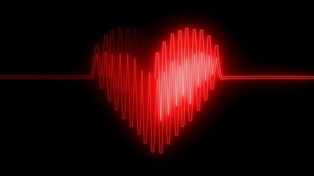 STAT+: An AI tool aims to catch harder-to-detect heart attacks in EKGs