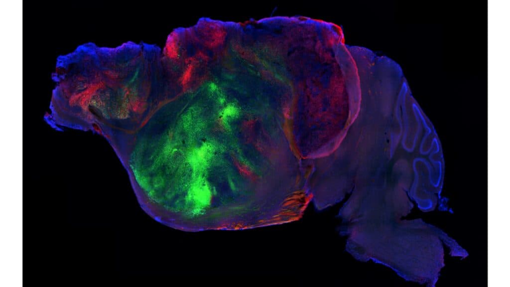 STAT+: Scientists made mice with half a brain. Then they filled them with human organoids