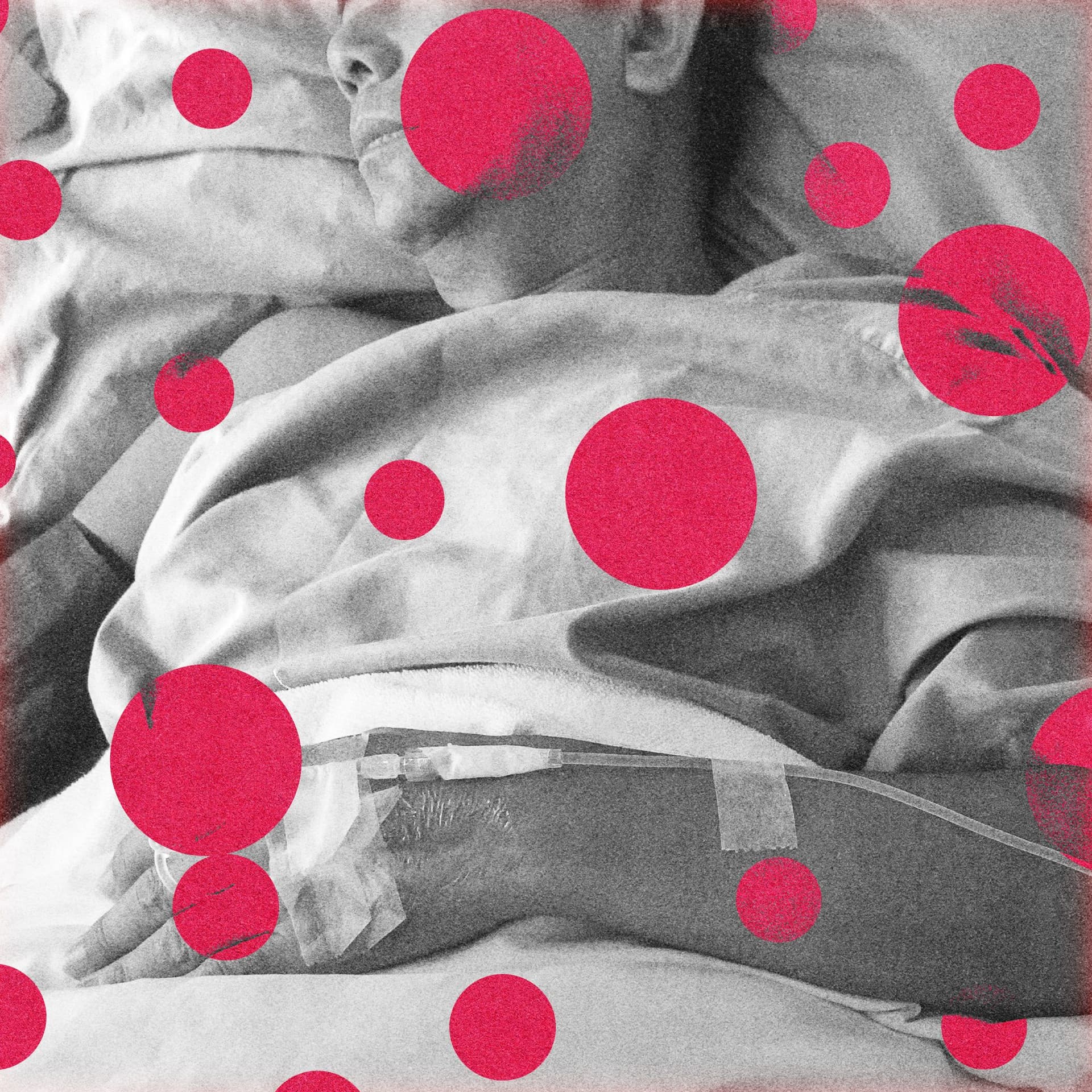 The US Just Recorded Its First 2 Measles Deaths This Year