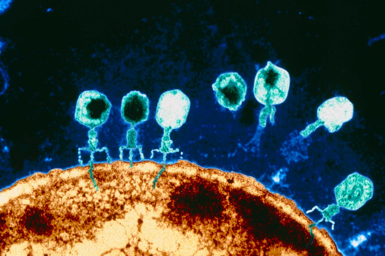CRISPR-armed phages help treat severe superbug infection