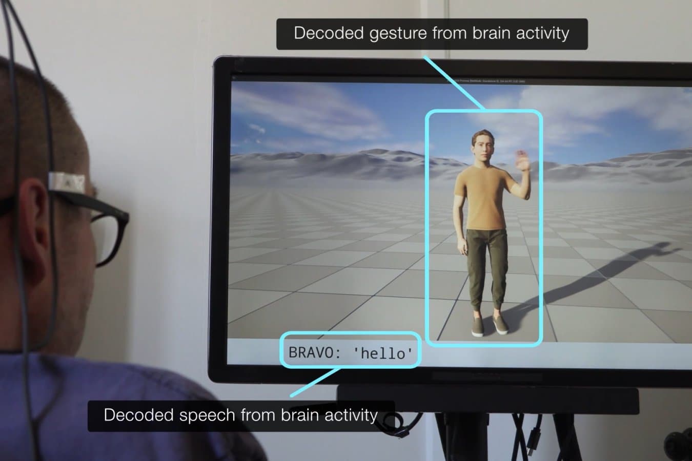 Brain implant lets people with paralysis speak and gesture at the same time