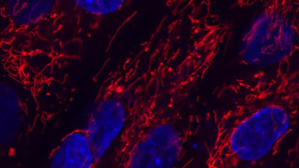 STAT+: Kyverna’s cell therapy shows lasting autoimmune benefit