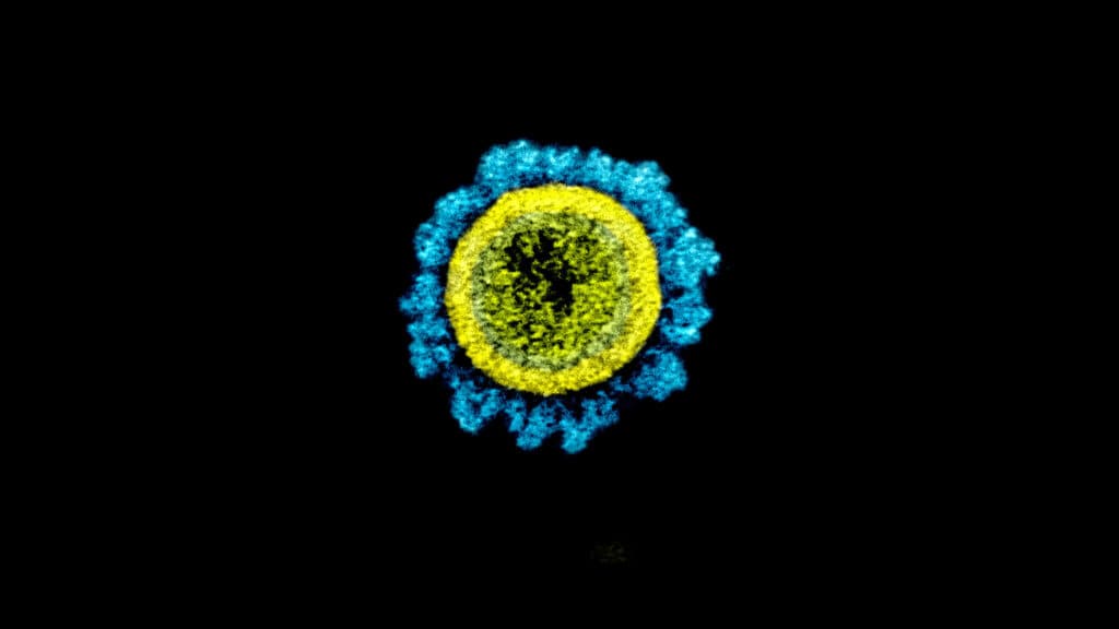 Federal government could improve infectious disease monitoring, says federal government