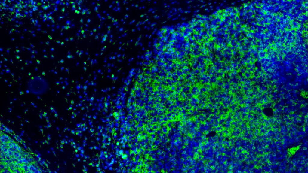 STAT+: Inhibrx claims first win for long-sought immunotherapy target