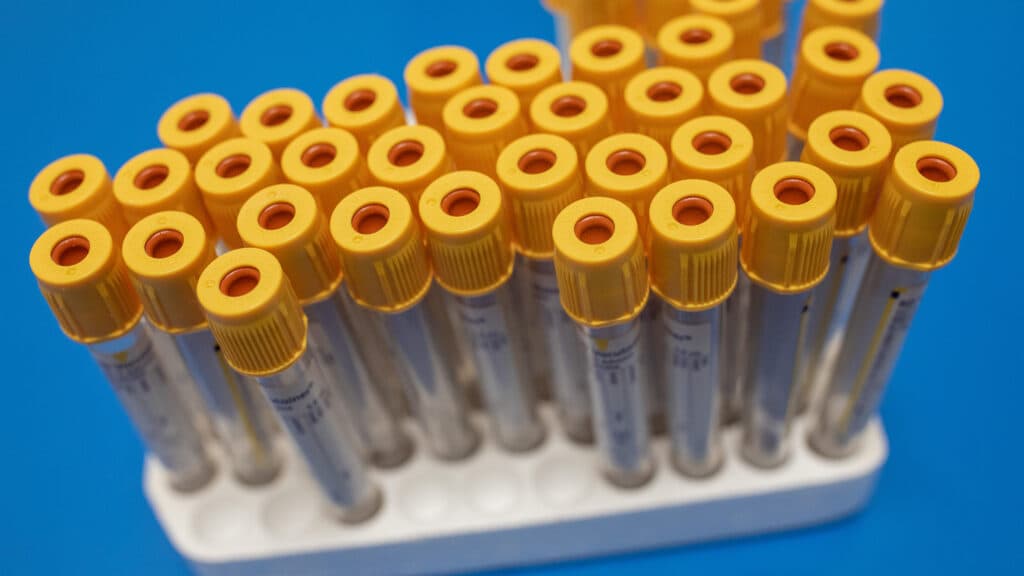 Opinion: Stopping doctors from ordering unnecessary diagnostic tests requires a structural fix