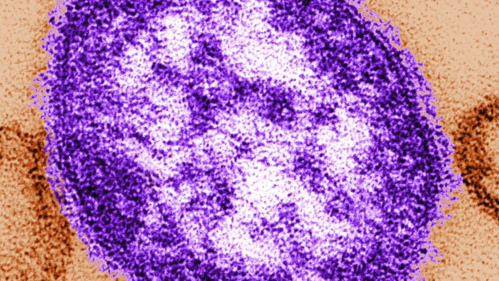 Coroner releases details of infants who died amid growing Pennsylvania measles outbreak